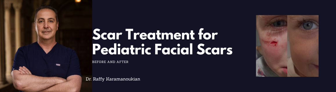 best plastic surgeon for kids in los angeles dr. karamanoukian