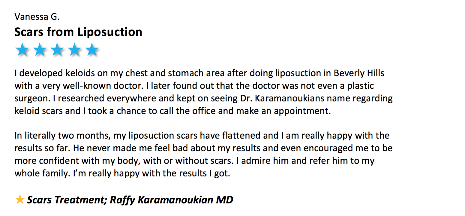 Review for Raffy Karamanoukian yelp Kare plastic surgery Santa Monica