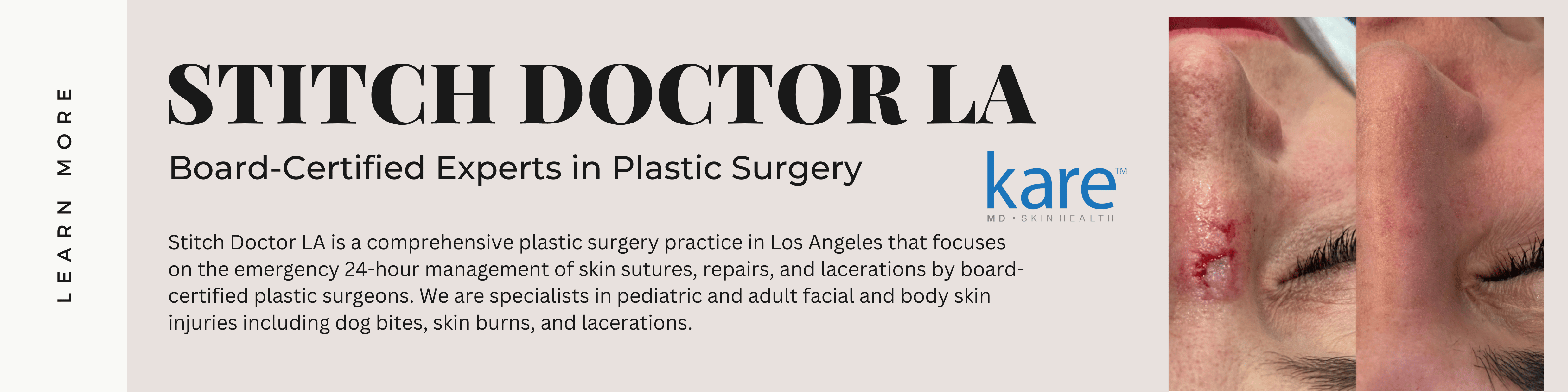 Stitch Doctor in Los Angeles Suture MD Stitch MD laceration emergency