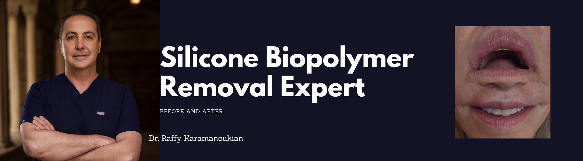 removal of silicone biopolymer before and after 
