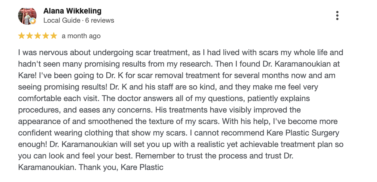 Patient social media review of Kare Plastic Surgery and Dr. Raffy Karamanoukian for scar and keloid removal in Santa Monica Los Angeles