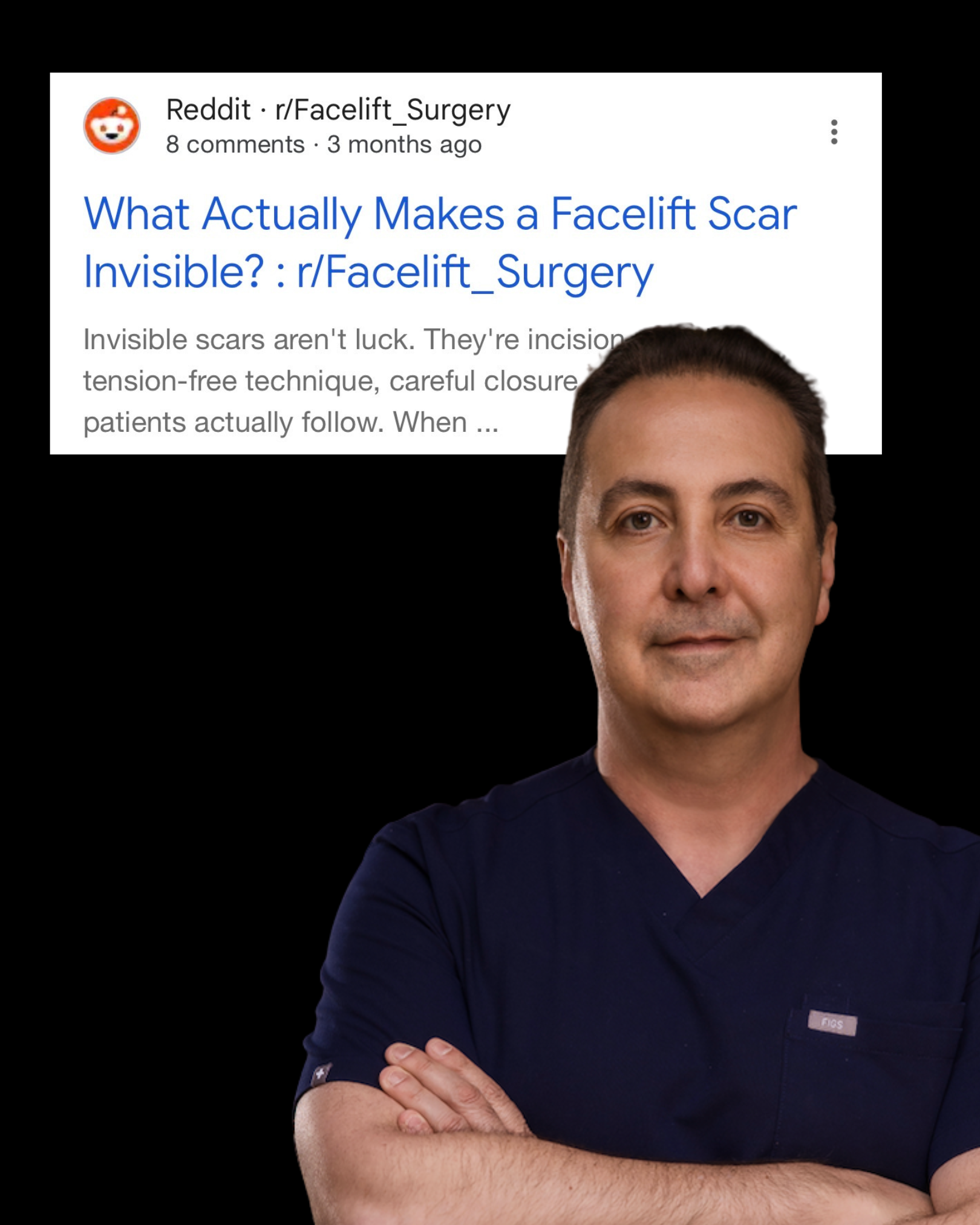 Dr. Raffy Karamanoukian MD FACS, dual board-certified plastic surgeon, Kare Plastic Surgery Santa Monica Los Angeles, expert in deep plane facelift scar revision laser treatment surgical re-excision and facelift complication correction, shown with Reddit r/Facelift_Surgery post on making facelift scars invisible
