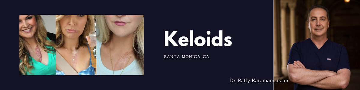 dr raffy karamanoukian treats surgical scars from plastic surgery