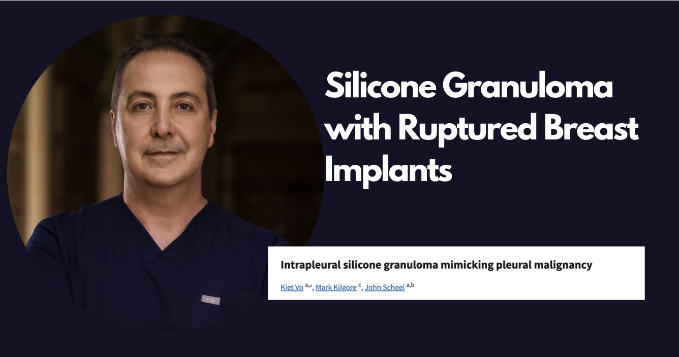 Silicone biopolymer removal in Los angeles with dr. raffy karamanoukian