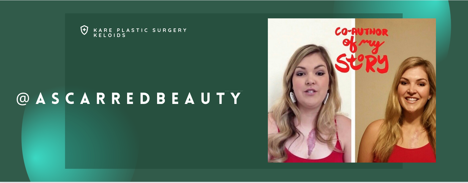 Reviews for Dr. Raffy Karamanoukian for scar removal