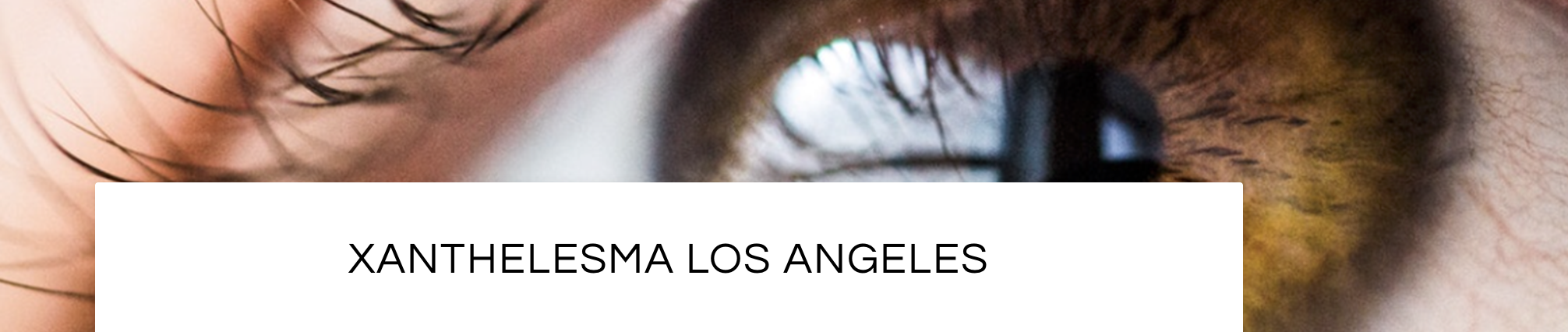 Xanthelesma Removal in Santa Monica and Beverly Hills