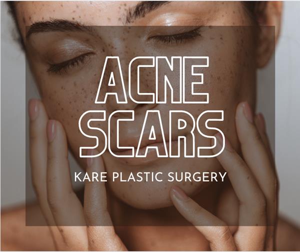 Scalp Laser Hair Removal Los Angeles Scalp Hair Removal Los Angeles