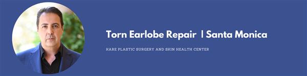 Stretched or Torn Earlobe Repair in Beverly Hills and Santa Monica